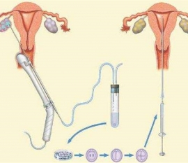 35岁女性备孕请做好以下检查，“健康温州代生宝宝”跑不远